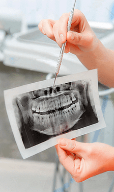 How do X-Rays see inside your mouth?