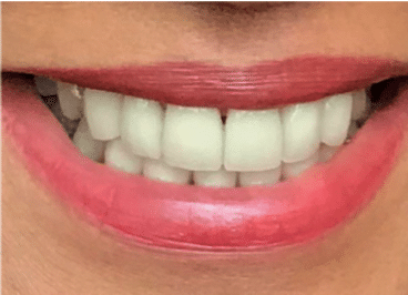 After with smile cosmetics restored