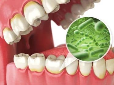 The ugly truth about “just a basic dental cleaning”