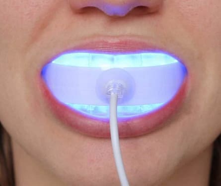 The truth about the teeth whitening products you see online.