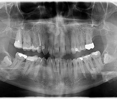 The Hidden Treasures Found In Dental X-rays!